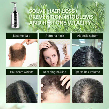 Sysni Organic Rosemary Shampoo And Tea Tree Special Shampoo, Keratin NourIshing Shampoo ,Promote Hair Growth, Strengthening Shampoo, Prevent Hair Loss Cleansing Shampoo,Deep Cleans, Refreshes Scalp, F
