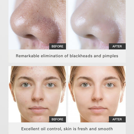 MUD MASK Daub-type MUD MASK Clean Blackheads