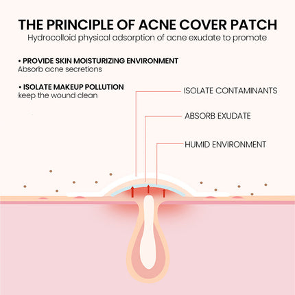Repair Acne Patch,200patches